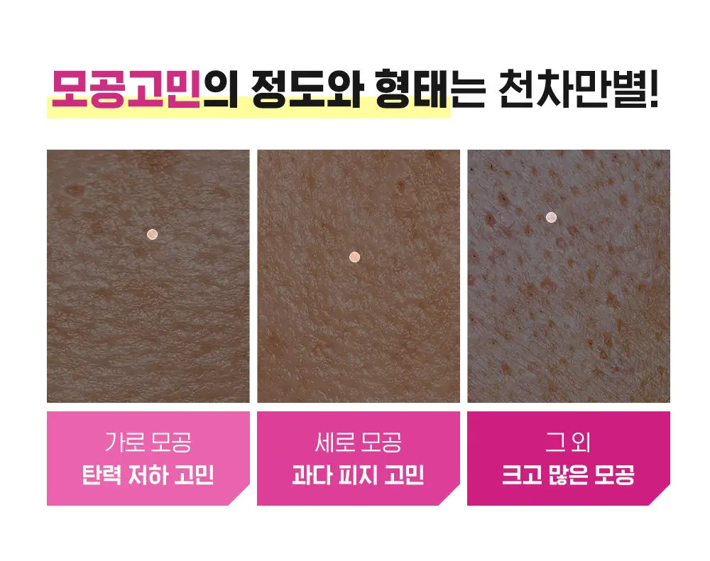 [곽민경PICK/단독기획] CKD 겔마스크 4+1매 (모공탄력/기미잡티) 2종 상세페이지 17